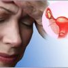 menopausa