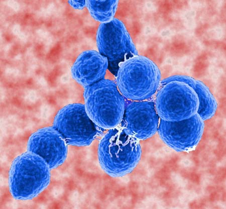 streptococcus pneumoniae