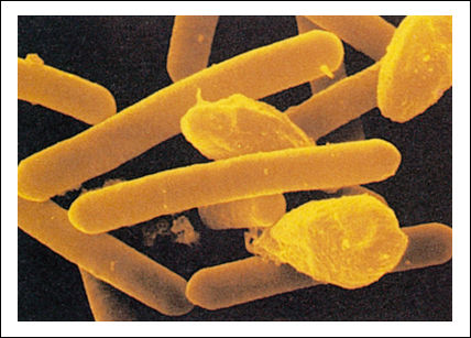 clostridium botulinum