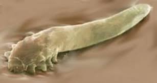 demodex